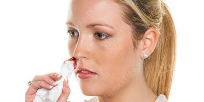 filmes sobre sangramento nasal